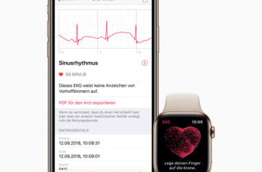 Apple iPhone watch ecg de screen 03272019 big