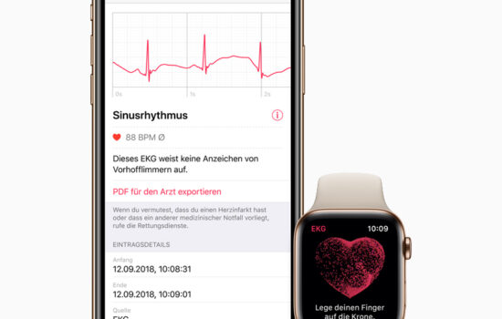 Apple iPhone watch ecg de screen 03272019 big