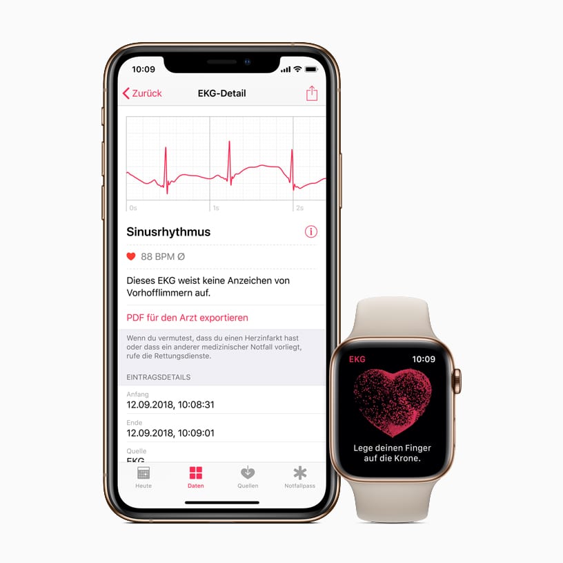 Apple iPhone watch ecg de screen 03272019 big