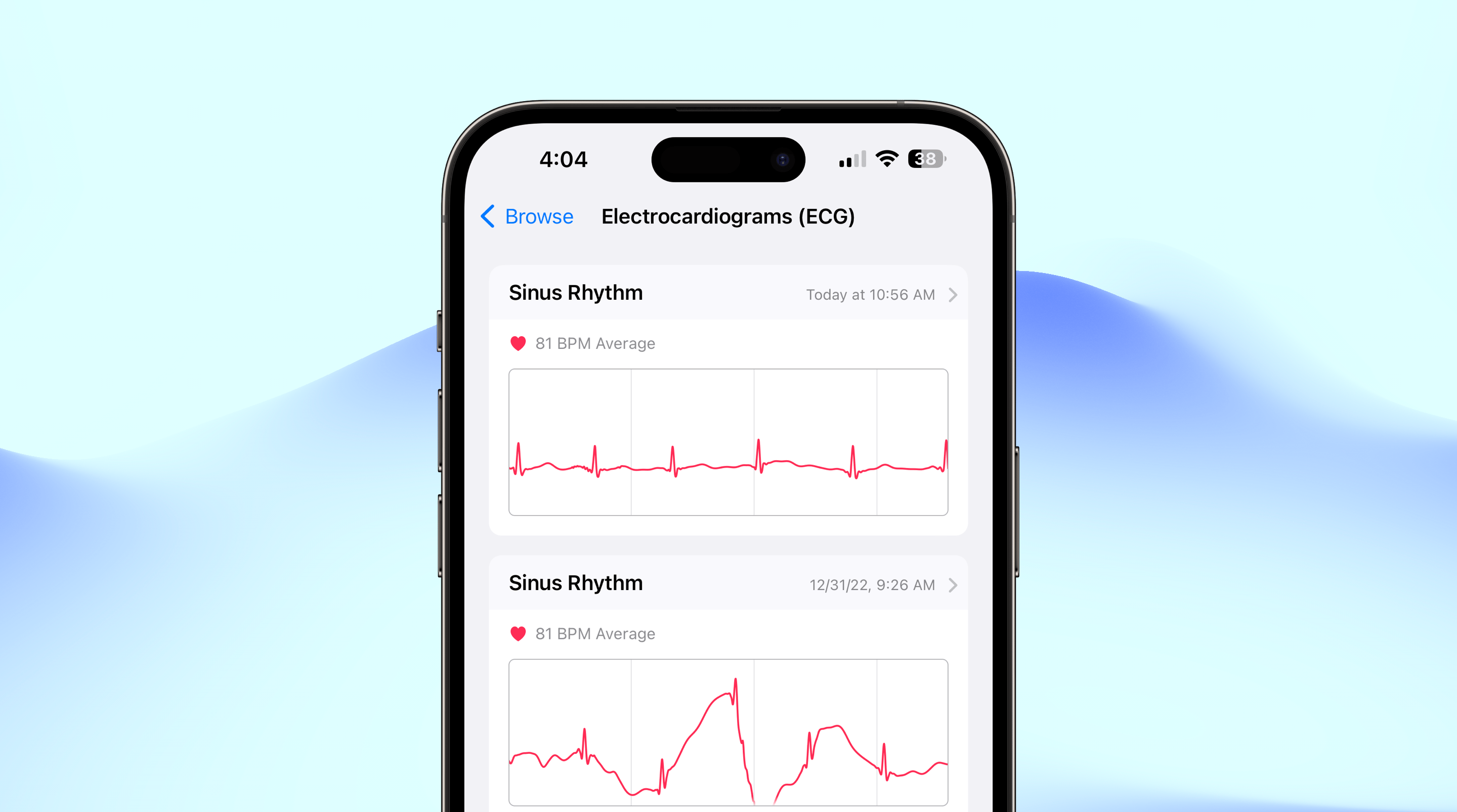 Bloomberg Reports: Apple planning to address mental health with Mood Tracker, AI Coach, and iPad Health app